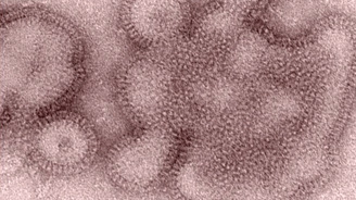 Variante del virus de la influenza H3N2