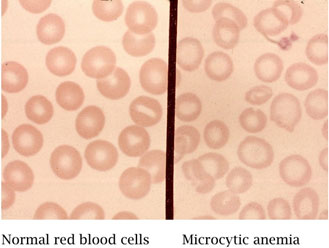 blood cells