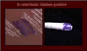 Oxidase Test