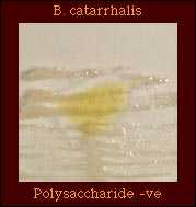 Polysaccharide from Sucrose