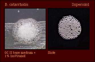 Superoxol Test (Reaction with 30% hydrogen peroxide)