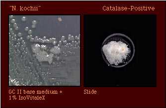 catalase