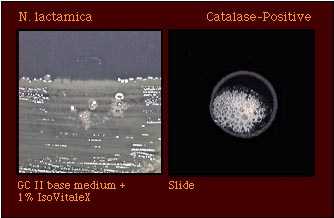 catalase