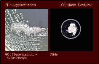 catalase