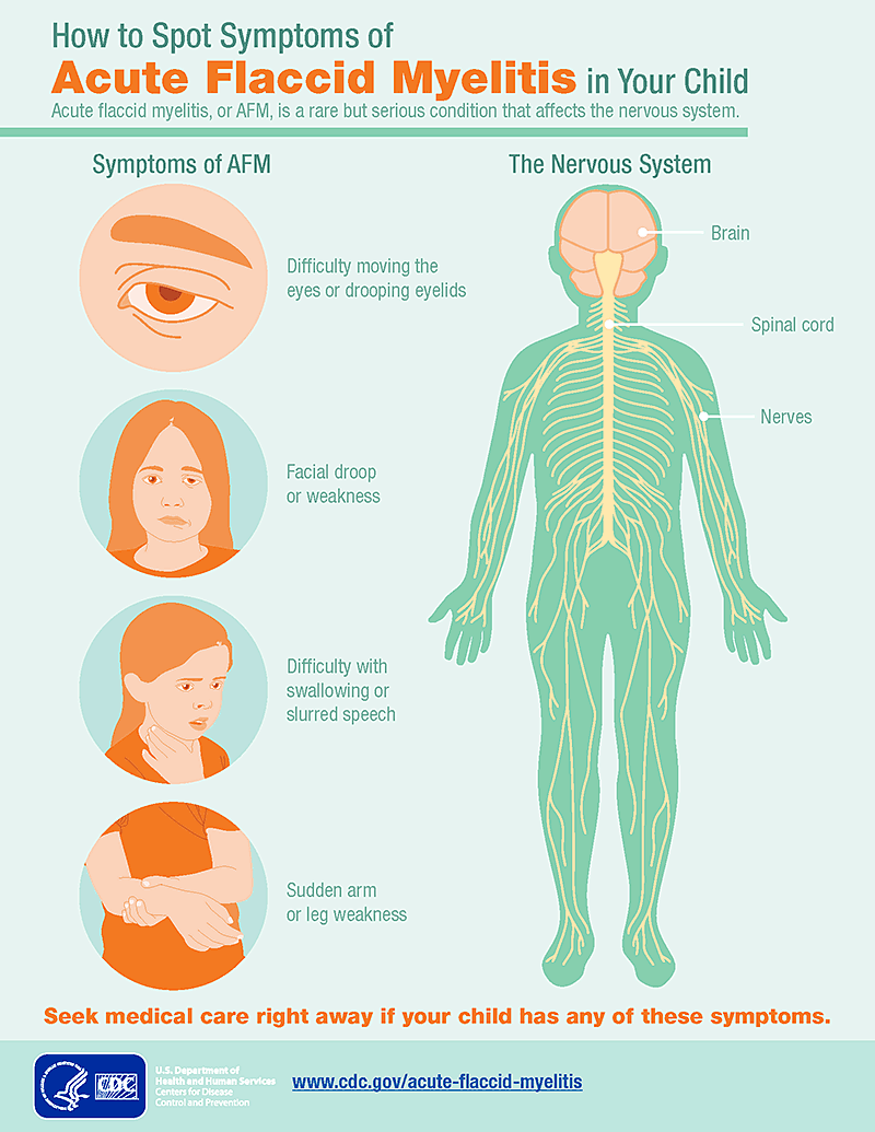 How to Spot Symptoms of Acute Flaccid Myelitis in Your Child infographic