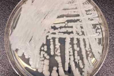 Candida auris, a fungus, growing in a petri dish