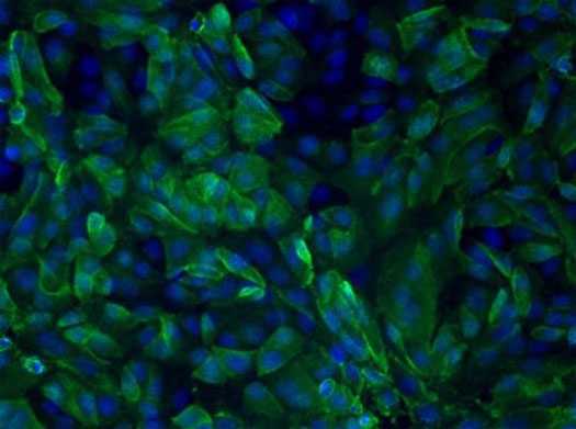 	Human serum antibodies react with MERS-CoV-infected Vero cells, indicating the patient has been infected with MERS-CoV.