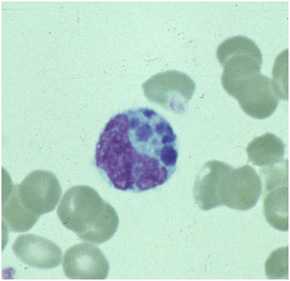 A granulocyte on a peripheral blood smear.