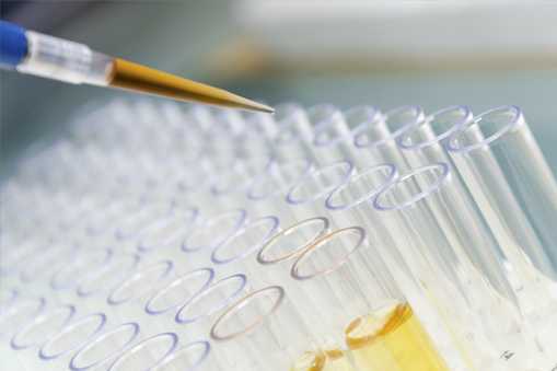 Rows of vials being filled with serum for testing