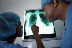 Two doctors looking at a lung x-ray