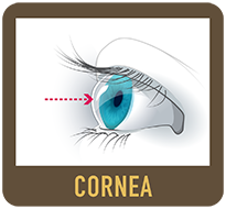 	Diagram of an eye cornea