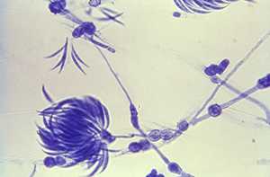 	the fungus Fusarium viewed under a microscope.