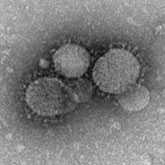 Novel coronavirus particles as seen by negative stain electron microscopy. Virions contain characteristic club-like projections emanating from the viral membrane.