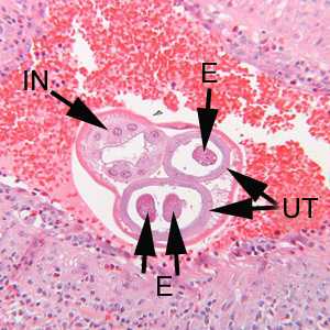 A. costaricensis adult female in tissue sections stained with H&E.