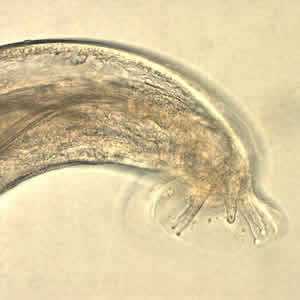 Angiostrongylus sp. male worm.