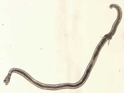 Angiostrongylus sp. male worm.