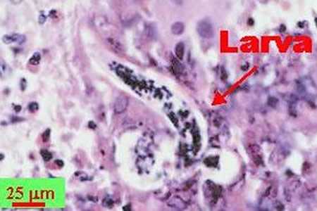 Angiostrongylus costaricensis eggs and larvae in tissue stained with hematoxylin and eosin (H&E).