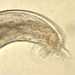 Angiostrongylus sp. male worm.