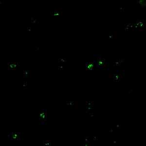 Positive IFA result with B. microti antigen.