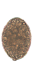 Diphyllobothrium latum egg