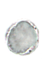 Blastocystis hominis wet mount