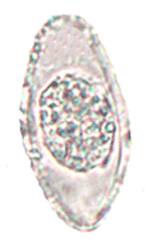 Cystoisospora belli wet mount