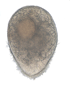 Balantidium coli trophozoite