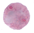 Dientamoeba fragilis