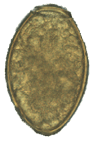 Paragonimus westermani egg