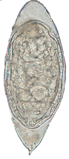 Schistosoma haematobium egg