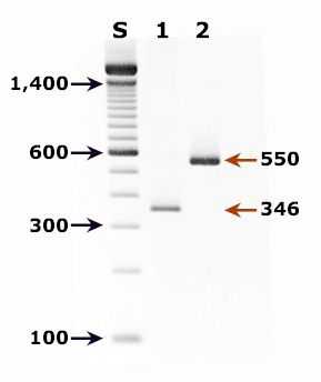 Molecular diagnosis of Pneumocystis jirovecii.