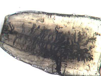 Mature proglottid of T. saginata, stained with India ink. Note the number of primary uterine branches (>12). Image courtesy of the Orange County Public Health Laboratory, Santa Ana, CA.