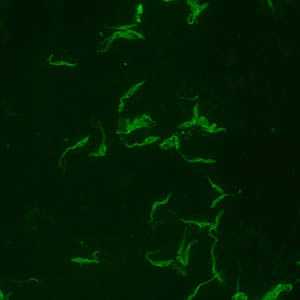 Positive IFA result with T. cruzi antigen (magnification 400x).