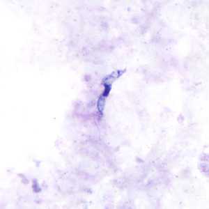 	Trypanosomiasis, African