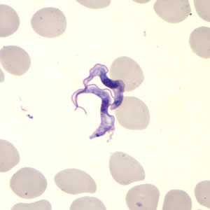 	Trypanosomiasis, African