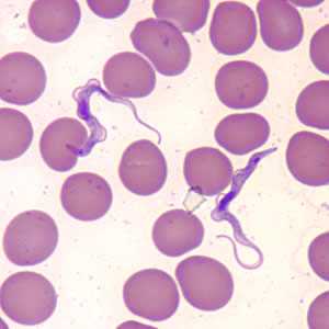 	Trypanosomiasis, African