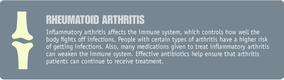 rheumatoid arthritis image