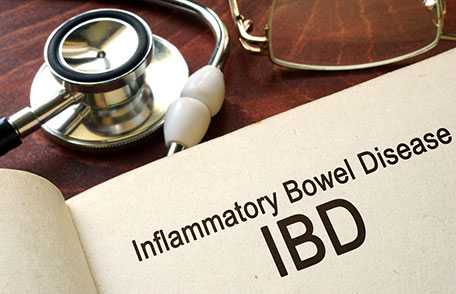 Inflammatory Bowel Disease