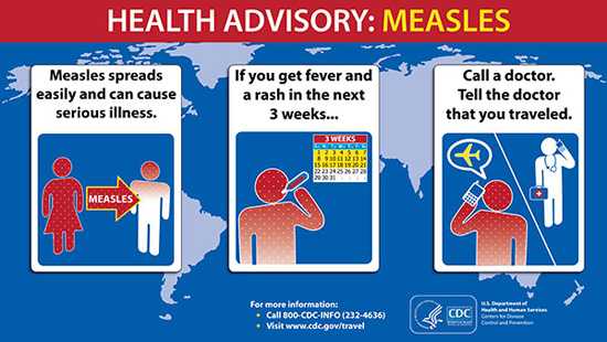 Measles spreads easily.