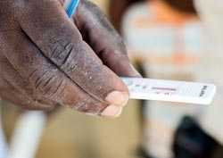 Hand holding malaria test kit