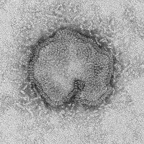 Electron Micrograph Images of H7N9 Virus from China