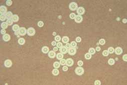 A photomicrograph of Cryptococcus neoformans using a light India ink staining preparation.