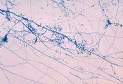 Photomicrograph of the dermatophyte Trichophyton mentagrophytes.