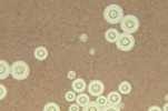 A photomicrograph of Cryptococcus neoformans using a light India ink staining preparation.