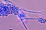 Photomicrograph showing conidiophores and conidia of the fungus Fusarium verticillioides