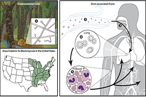 Sources of Infection