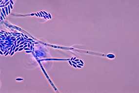 	Photomicrograph showing conidiophores and conidia of the fungus Fusarium verticillioides.