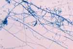 Photomicrograph of the dermatophyte Trichophyton mentagrophytes