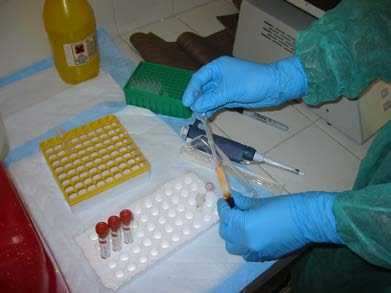 Vials of specimens with person wearing gloves