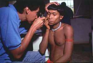 A physician exams the eyes of a male Yanomami indian. The indians attend the clinic for diagnosis and treatment of onchocerciasis and malaria. Credit: WHO/TDR/Mark Edwards